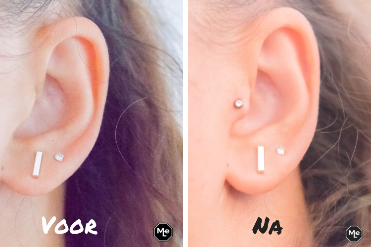 Nazorg Tragus Piercing: Tips voor een Succesvolle Genezing
